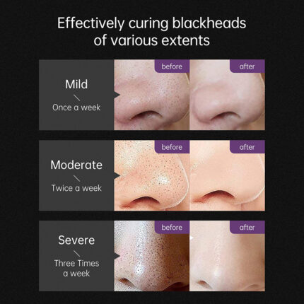 Blackhead Removing Nose Cream T Area Care Clean Shrink Pores Mask - Image 6